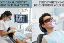 Root Canal Dentist