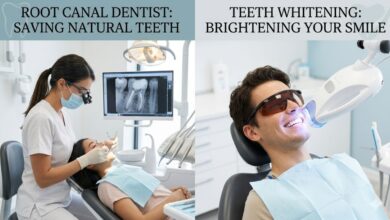 Root Canal Dentist